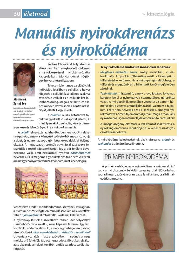 Manuális nyirokdrenázs és nyiroködéma